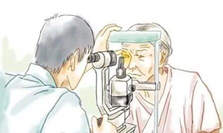 關(guān)于白內(nèi)障的六個秘密，老年人一定要知道！