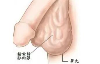 精索靜脈曲張，手術(shù)還是等待？