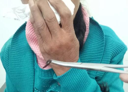 雞皮疙瘩掉一地，鼻子出螞蟥就在你身邊，你還敢喝生水嗎？