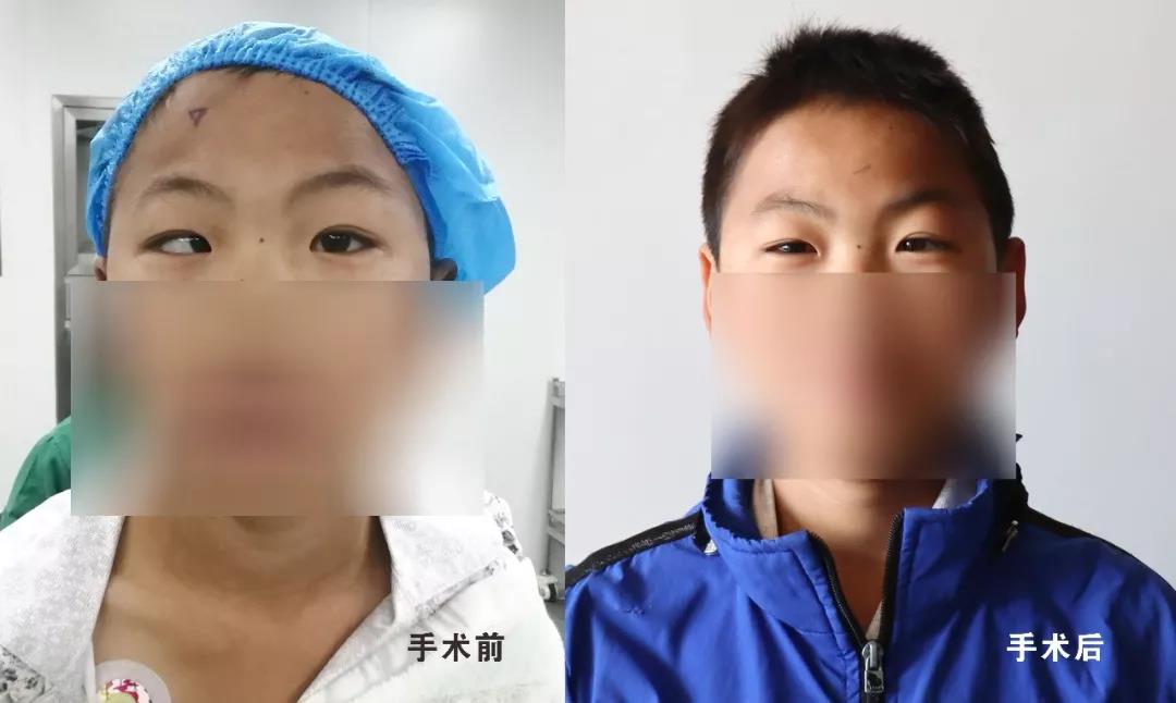 【保山安利醫(yī)院】?jī)和币暿中g(shù)再也不用跑省城了！