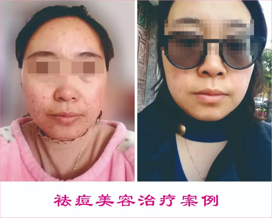 中醫(yī)駐顏，標(biāo)本兼治|中醫(yī)養(yǎng)生駐顏保健治療中心