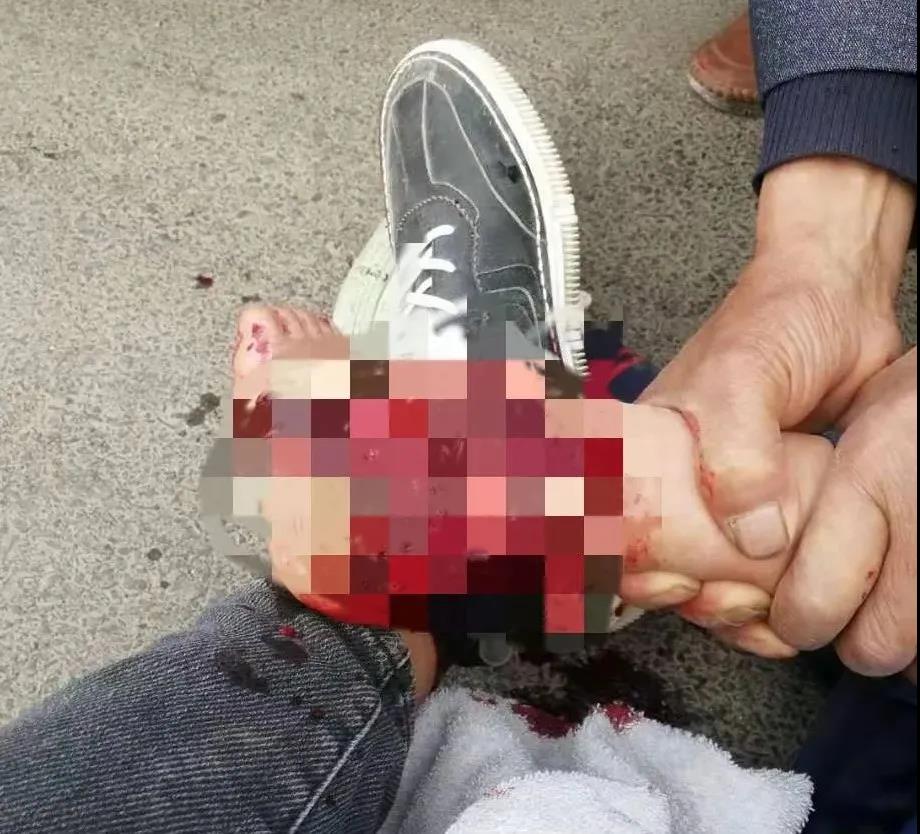 【保山安利醫(yī)院】創(chuàng)傷急救到處跑，不如安利把醫(yī)找！