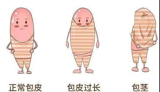 【保山安利醫(yī)院】家長速看！暑期包皮手術預約正當時！