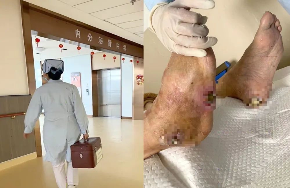 【保山安利醫(yī)院】傷口治療一站式，健康生活零距離！